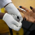 What Does HIV Stand For and Why It’s Crucial to Understand HIV in the Context of Modern Medicine and Prevention
