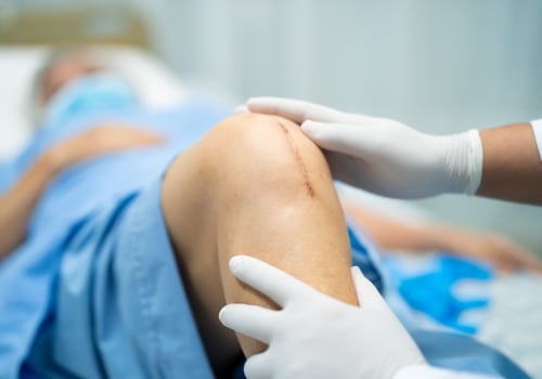 How Long Do Dissolvable Stitches Last? A Guide to Healing and Monitoring With PCR Testing