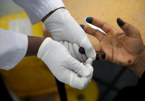 What Does HIV Stand For and Why It’s Crucial to Understand HIV in the Context of Modern Medicine and Prevention